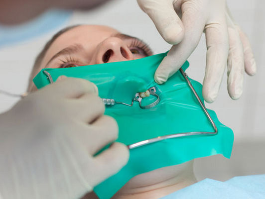 เขื่อนยางทันตกรรมบริสุทธิ์ วัสดุแก้มยาง Retractor แผ่นเขื่อนยาง